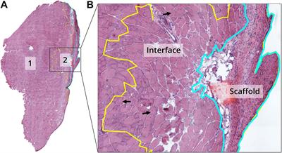 Elastin-Like Recombinamer Hydrogels for Improved Skeletal Muscle Healing Through Modulation of Macrophage Polarization